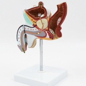 인체 남성 비뇨생식기계 병리학적 모형 1:1