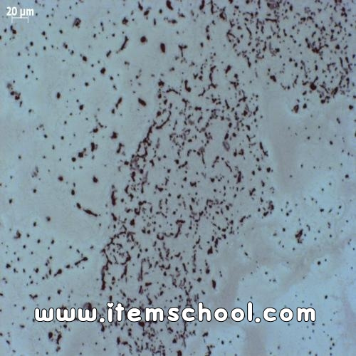 박테리아 편모충(Bacterial Flagella)