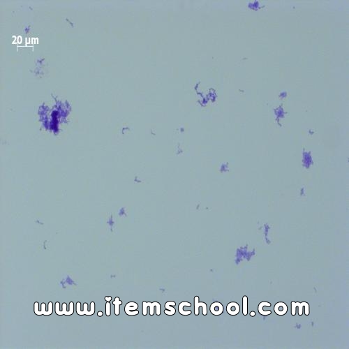 연쇄상구균(Streptococcus)