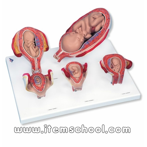 임신모형시리즈, 5 가지 모형